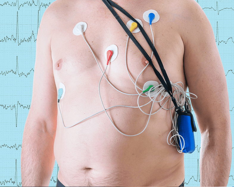 Consulta los <strong>Precios de Holter</strong> de <strong>Ritmo</strong>